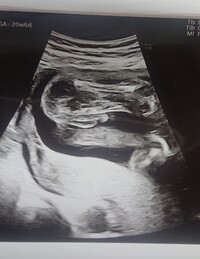 胎児の性別についてです 先日週の検診で男の子と言われました 写真がそ Yahoo 知恵袋