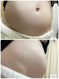 妊娠4ヶ月のお腹画像 Saikonocompmuryogazo