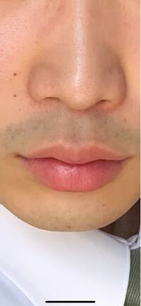 今付き合ってる人なんですけど ヒゲが濃すぎて無理です いつもちゃんと剃 Yahoo 知恵袋