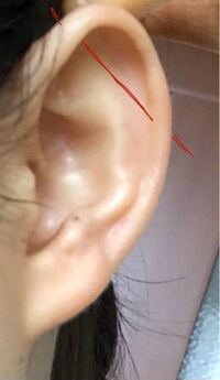 インダストリアルをこのように開けたいと思ってるんですが すごく軟骨が薄く耳の巻 Yahoo 知恵袋