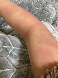 お酒飲むとすぐ顔赤くなって 周りに心配されるんですけど 自分自身は酔ってな Yahoo 知恵袋