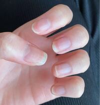 ハイポキニウムを育てたいのですがどのくらい爪を切った方がいいのか分かりません Yahoo 知恵袋