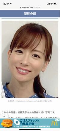 皆藤愛子はどちらかと言うとおばさんですか？お姉さんですか？写真が現在の顔です。 