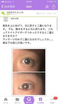 中3男子なんですけど二重になりたくて今日からヘアピンで癖付けし Yahoo 知恵袋