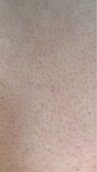 17歳です 毛深すぎてお腹にもこのように沢山濃い毛が生えてます Yahoo 知恵袋