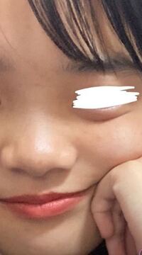 豚鼻 治す 知恵袋