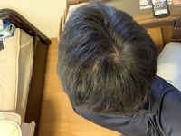 ハゲに関しての質問です つむじ二つあります 普段はこんな感じでそんなにハ Yahoo 知恵袋