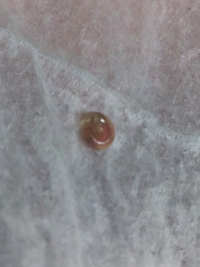 この虫 はなんでしょうか メダカを飼っている水槽に写真のような巻貝的なの Yahoo 知恵袋