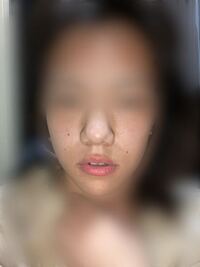 私の顔は顎変形症なんでしょうか 顔が左右非対称なんですがどうなんでし Yahoo 知恵袋