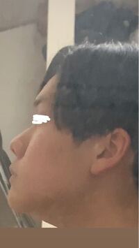 横顔がブッサイクで見られるのが怖いので改善したいです どうすれば良くなりますか Yahoo 知恵袋