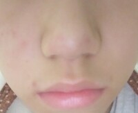 鼻を洗濯バサミで挟むと 鼻が細くなったり 高くなったりこの効果は本当です Yahoo 知恵袋