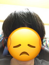 こんな風に もみあげがはねてしまうのが癖になってて 学校ではツ Yahoo 知恵袋