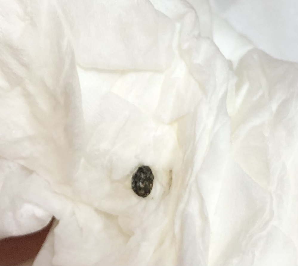 こんな小さい丸いムシは何でしょうか 家のいろんなところで存在していま Yahoo 知恵袋