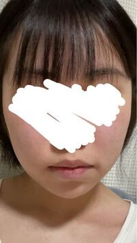 汚い写真ですいません高校生女子です 昔から頬肉が分厚く顔がパンパンで大きいこ Yahoo 知恵袋