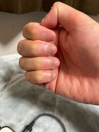 子供の頃から爪を噛んで食べる癖が治りません どうやったら治りま Yahoo 知恵袋