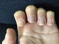 バイトの面接があるのですが飲食店だとこの爪の長さはさすがに不採用ですか Yahoo 知恵袋