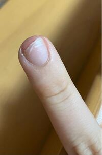 至急お願い致します スカルプを付けていたのですが 衝撃で取れてしまって自 Yahoo 知恵袋