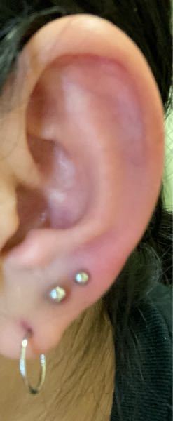 ピアスをあけて3ヶ月経過しました ずっとファーストピアスをつ Yahoo 知恵袋