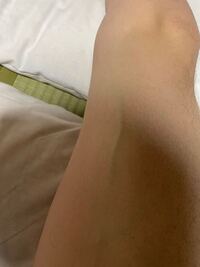 質問です 最近筋トレと午前中断食しているのですが右の太ももの写真のとこの Yahoo 知恵袋