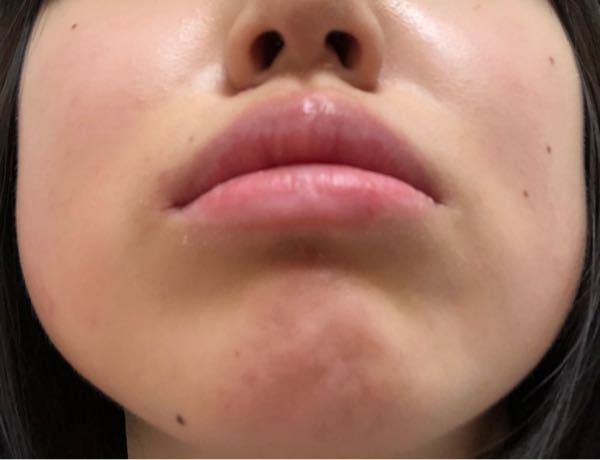 閲覧注意 写真あります 15歳です 私は出っ歯で歯並びが汚くて 4年ほど Yahoo 知恵袋