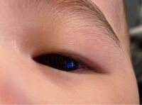 生後３週間の赤ちゃんがいるんですが眉毛が日に日に抜けてなくなっています Yahoo 知恵袋
