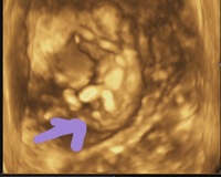 今妊娠13週で今日はじめて4dエコーをしました はじめての4d体験にとて Yahoo 知恵袋