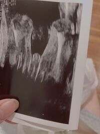 質問です 妊娠21週です 性別なにかわかりますでしょうか よろしくお願い Yahoo 知恵袋
