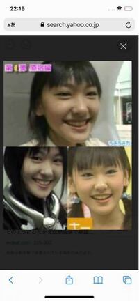 新垣結衣は整形ですよね 結婚がどうの騒いでますが Yahoo 知恵袋