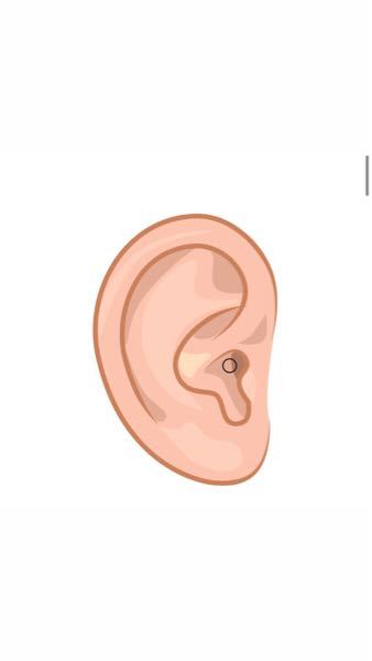 耳の病気 解決済みの質問 Yahoo 知恵袋