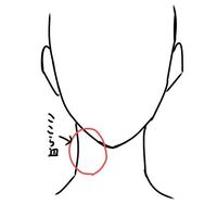 喉の骨 顎の下の方が急に突っかかるように痛くなります 飲み込んだりするのも痛く Yahoo 知恵袋