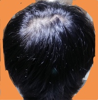 一歳の娘ですが つむじが２つあります 調べてみたらつむじが２つあると育てに Yahoo 知恵袋