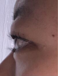 瞼の脂肪を落とす方法を教えてください 手術とかは依存したら困る Yahoo 知恵袋