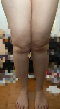 163cm70 です 太ってるのですが痩せている時からずっと足だ Yahoo 知恵袋