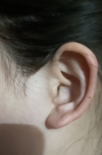 ピアスを開けたいのですが 正面から見た時耳が少し前のめり気味です Yahoo 知恵袋