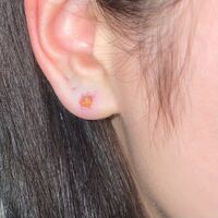 ピアス開けて1年以上経つんですけど この液が止まりません どうしたらいいですか Yahoo 知恵袋