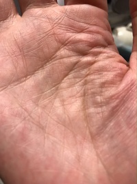 手のひら中央に五芒星がありますすごいですか 初めて見たぜ Yahoo 知恵袋