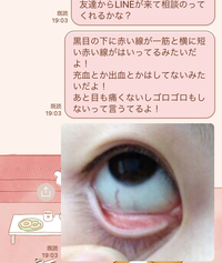 白目の所に赤い線が一筋ついてるのですか大丈夫ですか 黒目にはかかって Yahoo 知恵袋