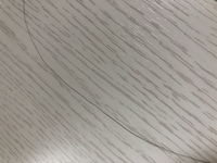 代女です 頭頂部に画像のようなガタガタな髪の毛が沢山あります Yahoo 知恵袋