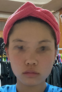 顔が非対称で写真の通り左の頬と鼻が大きいです これは顔が歪んでいるの Yahoo 知恵袋