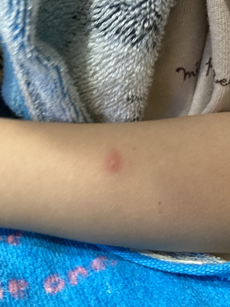 軟膏なら何でも皮膚のかぶれに効きますか 手洗いや乾燥に Yahoo 知恵袋