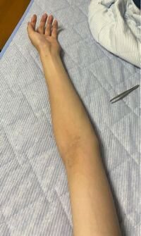 腕が細い男って女性から見て気持ち悪いですか 本当にガリガリ Yahoo 知恵袋