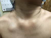 7歳の娘なのですが 朝から微熱があり学校を休ませて様子を見ていましたが先程お風 Yahoo 知恵袋