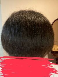 この髪質を治す方法ありますか すいてますか クセを直すと言う事 Yahoo 知恵袋