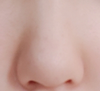 横から見ると鼻は高いのですが真正面から見るとこの様に団子鼻です 整形等はしたく Yahoo 知恵袋