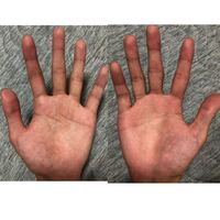 手相占いをお願いします 右手が左手か どちらがいいのが迷ったの Yahoo 知恵袋