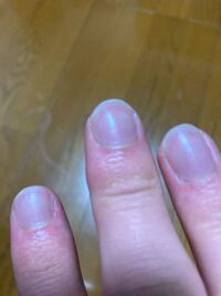 この爪の先端の白い部分 なんていう名前なのかはわかりませんが を白くキープする Yahoo 知恵袋