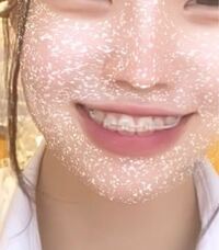 歯列矯正をしている女性は気持ち悪いですか 私は歳です 歯列矯正をすることが Yahoo 知恵袋