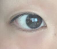 目頭切開をしようと思うのですが蒙古襞はあるものの目頭は元々尖りがちな Yahoo 知恵袋