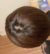 最近つむじが気になってきました また 渦を巻いてないんですがこれって Yahoo 知恵袋