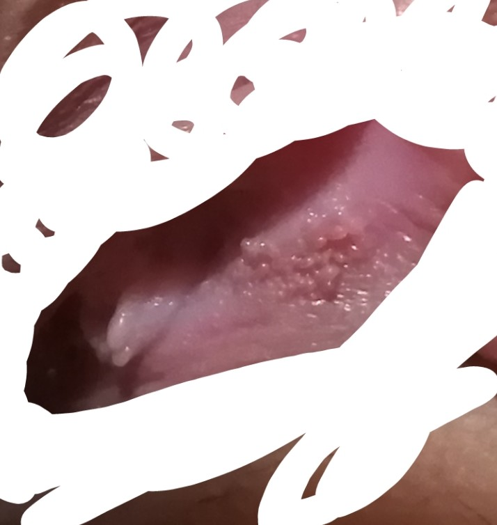 性病 性感染症 解決済みの質問 Yahoo 知恵袋